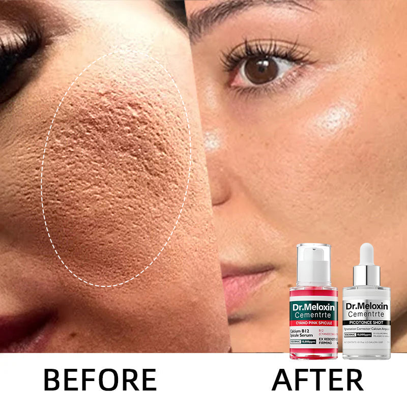 💥Shrinks Pores & Fades Blemish Marks in 2 Weeks | Cyano Pink Spicule Serum+Picotonic Shot Ampoule