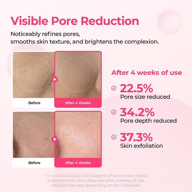 💥Shrinks Pores & Fades Blemish Marks in 2 Weeks | Cyano Pink Spicule Serum+Picotonic Shot Ampoule