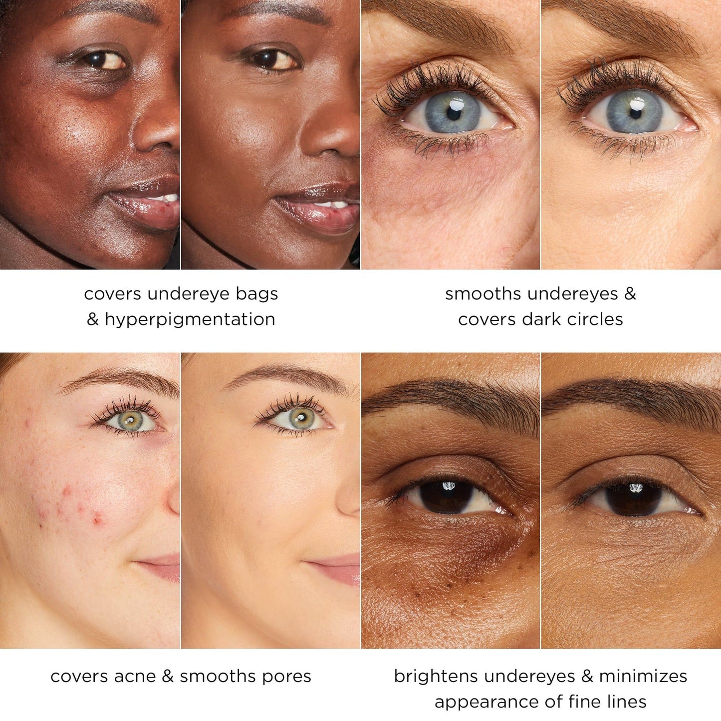 Final 3 Hours: 60% OFF🔥 Blue Concealer Stick