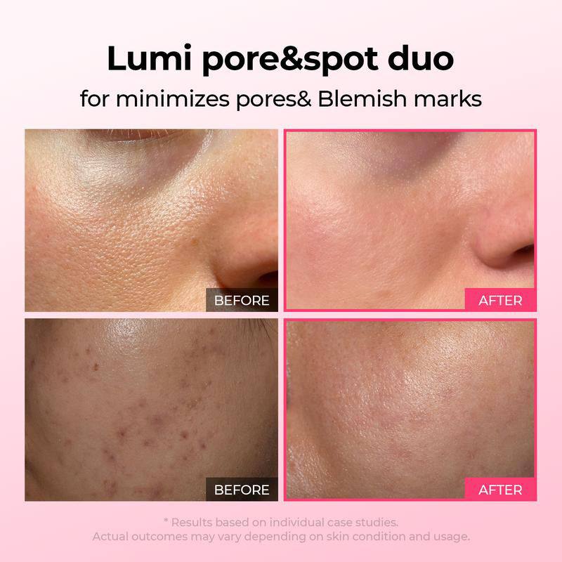💥Shrinks Pores & Fades Blemish Marks in 2 Weeks | Cyano Pink Spicule Serum+Picotonic Shot Ampoule